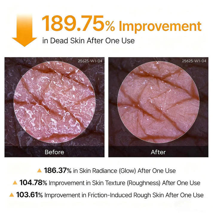 Klivry Peel Shot - Kojic + Turmeric Body Peel Spray