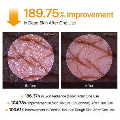 Klivry Peel Shot - Kojic + Turmeric Body Peel Spray