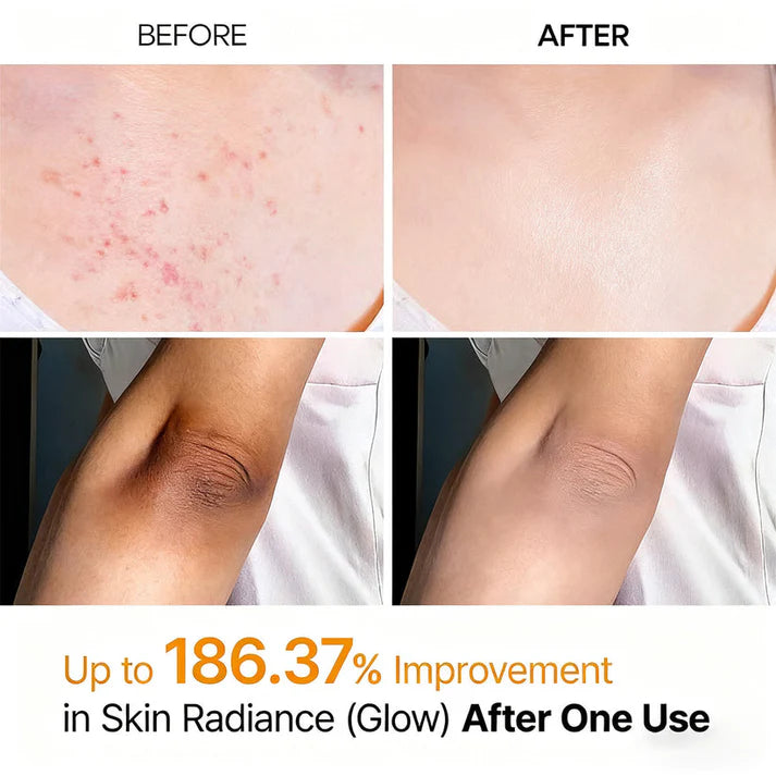 Klivry Peel Shot - Kojic + Turmeric Body Peel Spray